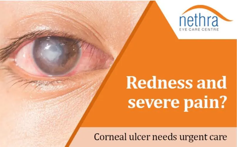 Eye Care Blogs on LASIK Cataract and Squint Treatment by Nethra Eye Care Centre